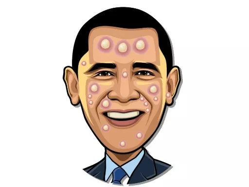 Celebrity Pimple Pop - Free Unblocked Game