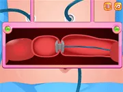 Colon Colectomy Surgery - Free Unblocked Game