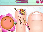 Funny Nail Doctor - Free Unblocked Game